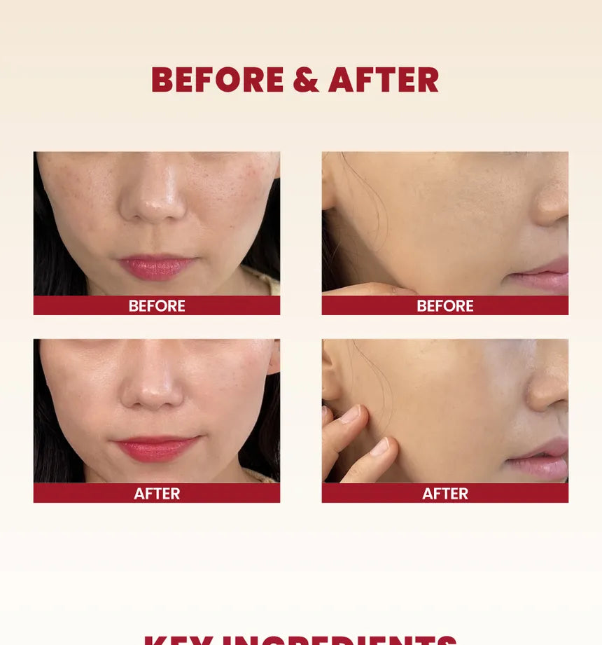 K-SECRET - SEOUL 1988 Snail Mucin 93% + Rice Cream 100ml