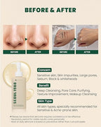 KSECRET - SEOUL 1988 Cleansing Oil : Pine Cica 1% + Probiotics